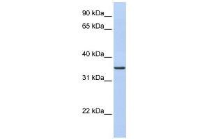 CDC42EP4 antibody used at 1 ug/ml to detect target protein.
