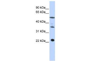 CENPM antibody used at 1 ug/ml to detect target protein. (CENPM anticorps  (Middle Region))