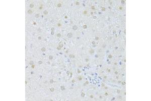 Immunohistochemistry of paraffin-embedded rat liver using SIRT1 antibody (ABIN6291361) at dilution of 1:100 (40x lens). (SIRT1 anticorps)