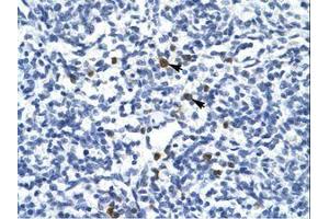 Image no. 1 for anti-T-Cell Acute Lymphocytic Leukemia 1 (TAL1) (AA 236-285) antibody (ABIN6735910) (TAL1 anticorps  (AA 236-285))