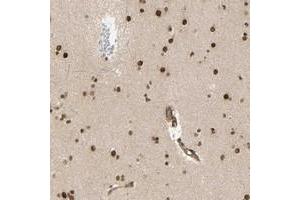 Immunohistochemical staining of human lateral ventricle with ZMYM6 polyclonal antibody  shows strong nuclear positivity in neuronal cells at 1:50-1:200 dilution. (ZMYM6 anticorps)