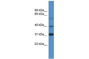 WB Suggested Anti-SOX1 Antibody Titration: 1. (SOX1 anticorps  (C-Term))