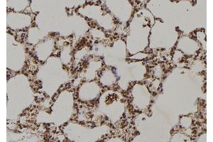 ABIN6263216 and ABIN6269229 at 1/100 staining Rat lung tissue by IHC-P. (MEK2 anticorps  (C-Term))