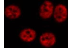 ABIN6267348 staining HeLa cells by IF/ICC. (MYB anticorps  (pSer532))