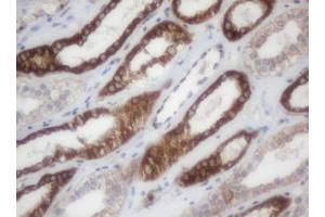 Image no. 1 for anti-NADH Dehydrogenase (Ubiquinone) 1 beta Subcomplex, 9, 22kDa (NDUFB9) (AA 3-179) antibody (ABIN1491361)