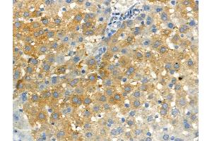 Phospho-RON (Ser1394) Antibody at 1/100 staining Rat liver tissue by IHC-P. (MST1R anticorps  (pSer1394))