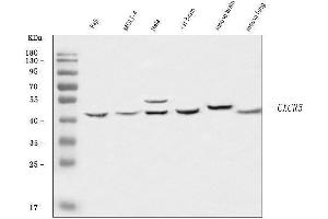 Western blot analysis of CXCR5 using anti-CXCR5 antibody (ABIN7600362). (CXCR5 anticorps  (AA 181-358))
