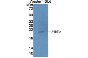 Western blot analysis of the recombinant protein. (ICAM-3/CD50 anticorps  (AA 46-197))