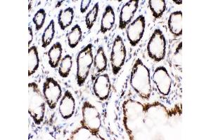 IHC analysis of MAD1 using anti-MAD1 antibody (ABIN3043387). (MAD1L1 anticorps  (AA 362-632))