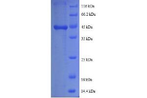 SDS-PAGE (SDS) image for Prefoldin Subunit 5 (PFDN5) (AA 2-154), (full length) protein (GST tag) (ABIN7479601)