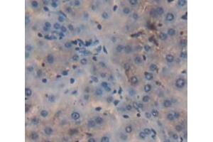IHC-P analysis of Rat Tissue, with DAB staining. (PCSK9 anticorps  (AA 164-428))