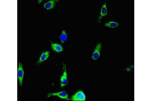 Immunofluorescent analysis of Hela cells using ABIN7144308 at dilution of 1:100 and Alexa Fluor 488-congugated AffiniPure Goat Anti-Rabbit IgG(H+L) (Anoctamin 4 anticorps  (AA 1-200))