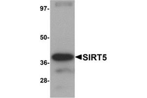 Western blot analysis of SIRT5 in human liver tissue lysate with SIRT5 antibody at 1 μg/ml. (SIRT5 anticorps  (C-Term))