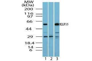 Image no. 1 for anti-Kruppel-Like Factor 15 (KLF15) (AA 100-150) antibody (ABIN960246) (KLF15 anticorps  (AA 100-150))