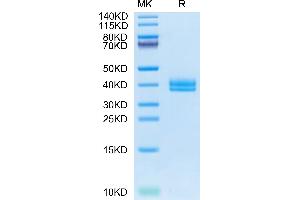 Cynomolgus IGFBP2 on Tris-Bis PAGE under reduced condition. (IGFBP2 Protein (AA 33-325) (His tag))