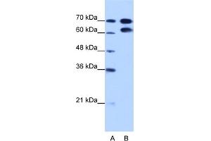 WB Suggested Anti-RAVER1 Antibody Titration:  1. (RAVER1 anticorps  (N-Term))