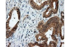 Immunohistochemical staining of paraffin-embedded Kidney tissue using anti-LIPG mouse monoclonal antibody. (LIPG anticorps)