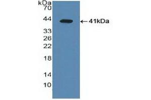 Detection of Recombinant LXRa, Human using Polyclonal Antibody to Liver X Receptor Alpha (LXRa)