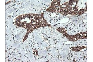 Image no. 1 for anti-Dynamin 1-Like (DNM1L) antibody (ABIN1497870)