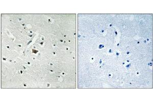 Immunohistochemical analysis of paraffin-embedded human brain tissue using PLD2 (Phospho-Tyr169) antibody (left)or the same antibody preincubated with blocking peptide (right). (Phospholipase D2 anticorps  (pTyr169))