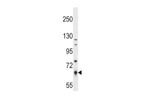 PKLR Antibody (S8) (ABIN391050 and ABIN2841209) western blot analysis in NCI- cell line lysates (35 μg/lane).