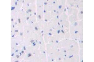 Used in DAB staining on fromalin fixed paraffin- embedded heart tissue (ANKRD1 anticorps  (AA 1-319))