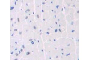 Used in DAB staining on fromalin fixed paraffin- embedded heart tissue (ANKRD1 anticorps  (AA 1-319))