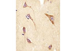 (ABIN6244245 and ABIN6578502) staining GNG2 in human brain tissue sections by Immunohistochemistry (IHC-P - paraformaldehyde-fixed, paraffin-embedded sections). (GNG2 anticorps  (AA 19-52))