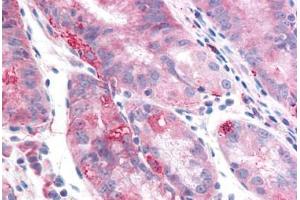 Human Stomach: Formalin-Fixed, Paraffin-Embedded (FFPE) (TMEM33 anticorps  (Internal Region))