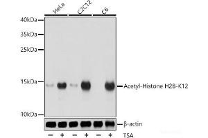 Western blot analysis of extracts of various cell lines using Acetyl-Histone H2B-K12 Polyclonal Antibody at dilution of 1:1000. (Histone H2B anticorps  (acLys12))