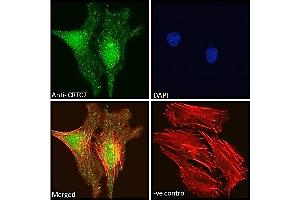 ABIN5539499 Immunofluorescence analysis of paraformaldehyde fixed HeLa cells, permeabilized with 0.