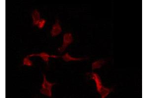 ABIN6274212 staining COLO205 by IF/ICC.