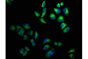 Immunofluorescence staining of Hela cells with ABIN7142963 at 1:100, counter-stained with DAPI. (CHRND anticorps  (AA 334-471))