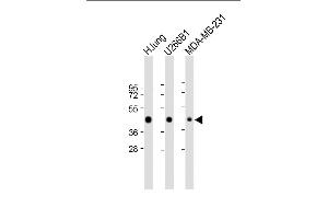 All lanes : Anti-HLA-F Antibody (Center) at 1:2000 dilution Lane 1: Human lung lysate Lane 2: U266B1 whole cell lysate Lane 3: MDA-MB-231 whole cell lysate Lysates/proteins at 20 μg per lane. (HLA-F anticorps  (AA 172-198))