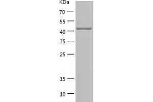 Western Blotting (WB) image for Actin-Like 6A (BAF53A) (AA 2-429) protein (His-IF2DI Tag) (ABIN7121656)