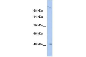 WB Suggested Anti-KIF1A Antibody Titration:  0. (KIF1A anticorps  (N-Term))