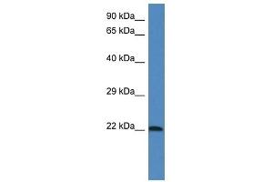 Western Blot showing 1110067D22Rik antibody used at a concentration of 1.