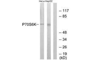 Western blot analysis of extracts from HeLa/HepG2, using p70 S6 Kinase (Ab-371) Antibody. (RPS6KB1 anticorps  (AA 337-386))