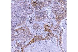 IHC analysis of WDR44 using anti-WDR44 antibody (ABIN7600394). (WDR44 anticorps  (AA 188-913))