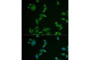 Immunofluorescence analysis of U2OS cells using MLANA Polyclonal Antibody (MLANA anticorps)