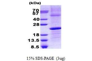 Image no. 1 for Immunoglobulin lambda-Like Polypeptide 1 (IGLL1) protein (His tag) (ABIN1098784)