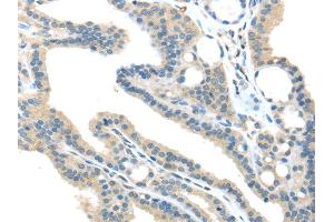 Immunohistochemistry (IHC) image for anti-Vacuolar Protein Sorting 36 (VPS36) antibody (ABIN5959966) (VPS36 anticorps)
