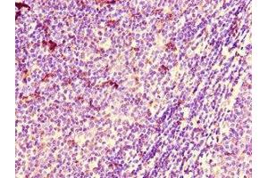 Immunohistochemistry of paraffin-embedded human lymph node tissue using ABIN7150983 at dilution of 1:100 (ARIH2 anticorps  (AA 43-360))