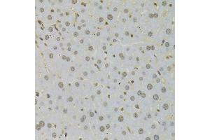 Immunohistochemistry of paraffin-embedded mouse liver using HMGB1 Antibody. (HMGB1 anticorps  (AA 100-200))