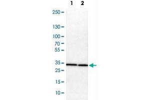 Western Blot analysis of Lane 1: NIH-3T3 cell lysate (mouse embryonic fibroblast cells) and Lane 2: NBT-II cell lysate (Wistar rat bladder tumor cells) with ARPC2 polyclonal antibody .
