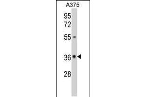 Western blot analysis of GALE Antibody in A375 cell line lysates (35ug/lane)