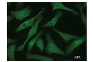 Immunostaining analysis in HeLa cells.