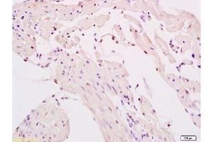 Formalin-fixed and paraffin embedded rat myocardium tissue labeled with Anti-SMURF2 Polyclonal Antibody, Unconjugated at 1:200 followed by conjugation to the secondary antibody and DAB staining