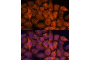 Immunofluorescence analysis of HeLa cells using RP antibody (ABIN7270101) at dilution of 1:100.