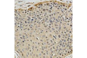 Immunohistochemistry (IHC) image for anti-Proteasome (Prosome, Macropain) Subunit, beta Type, 9 (Large Multifunctional Peptidase 2) (PSMB9) (AA 1-219) antibody (ABIN3022518)